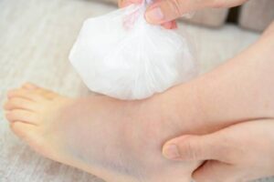 足首の捻挫で貼れにアイシング