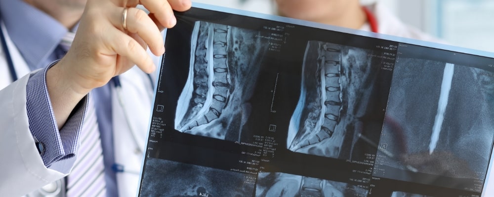 交通事故へのMRI検査やレントゲン検査