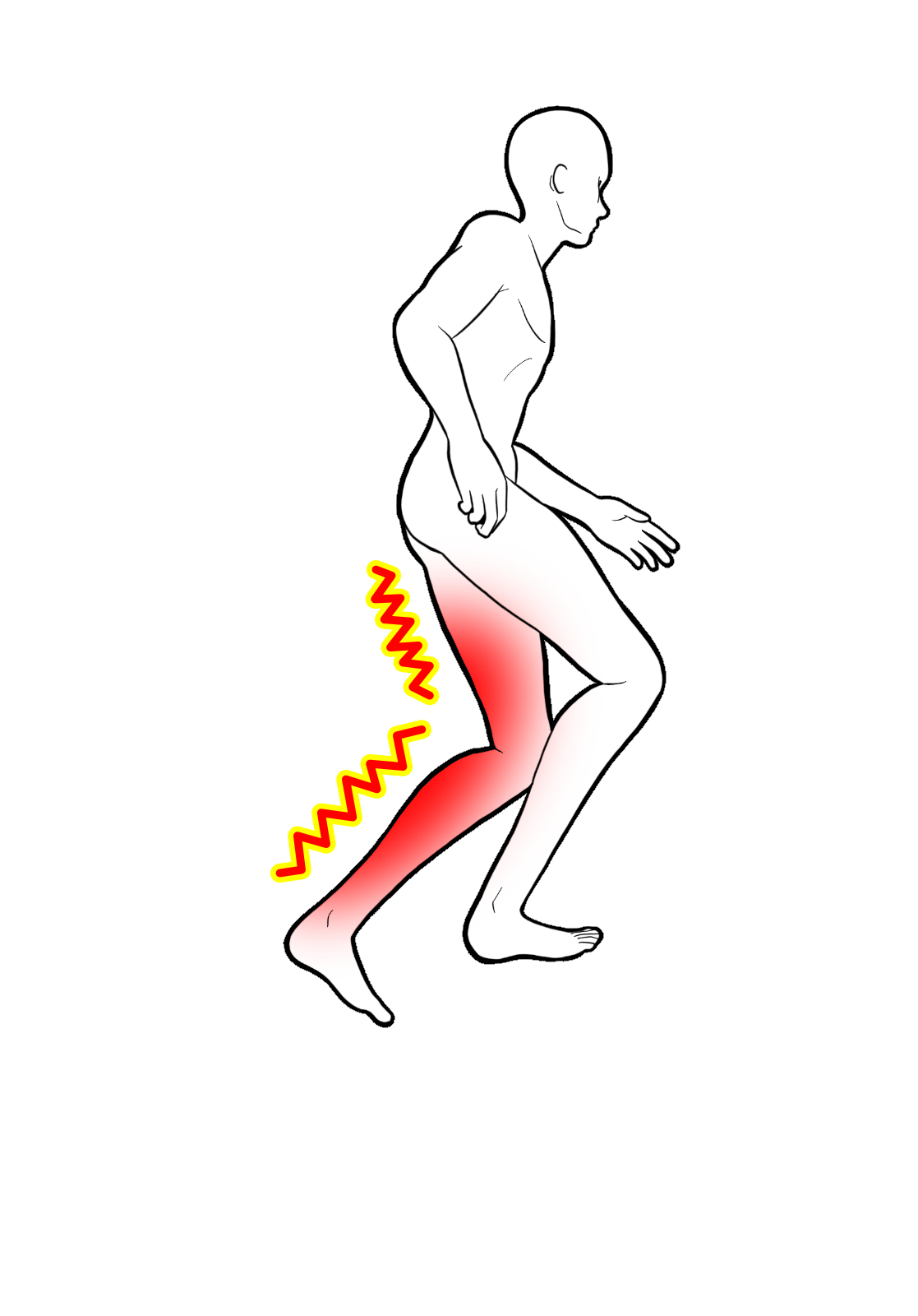 坐骨神経痛の足のしびれや痛みを治療する整骨院
