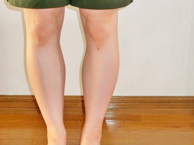 O脚の治療をする志木駅の整体院